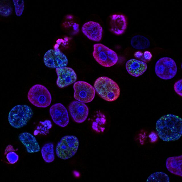 Human Cancer Cells