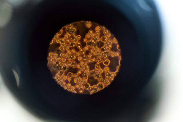 Microscope showing blood cells